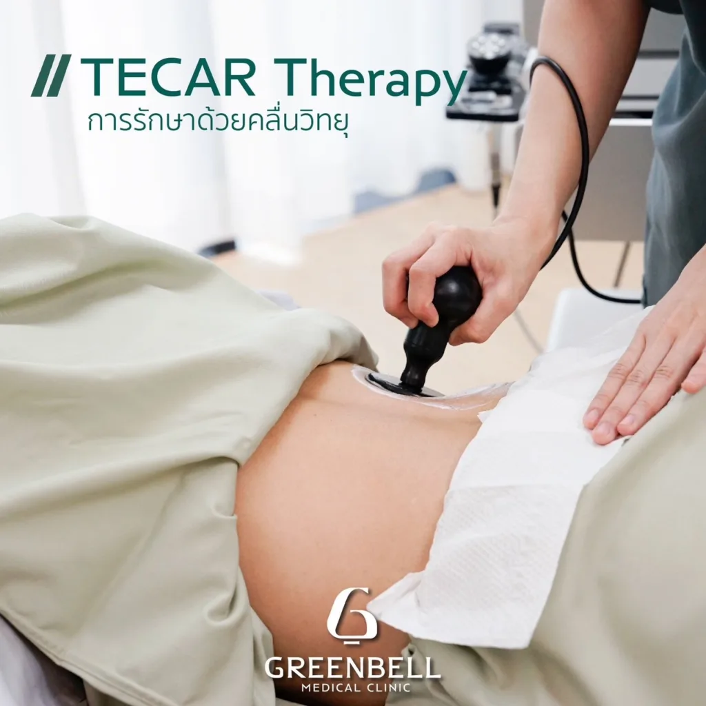 TECAR Therapy คืออะไร, Greenbell Clinic