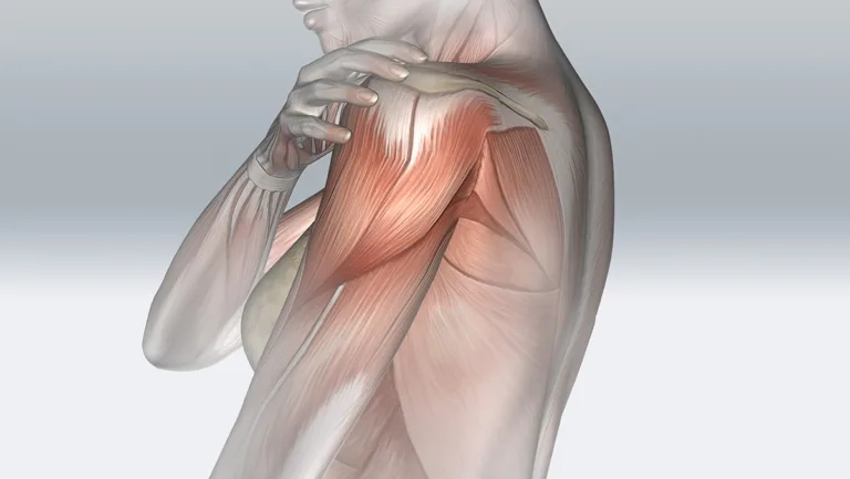 3D female figure holding shoulder with muscle map