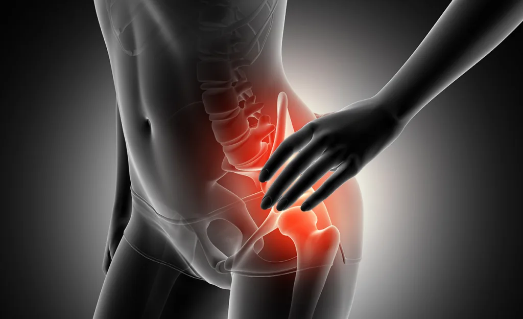 Can Weak Glutes Causes Low Back Pain? Medical Blog 3D female figure holding hip in pain with skeleton highlighted