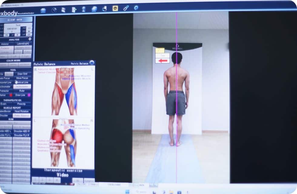 posture analysis, Greenbell Clinic