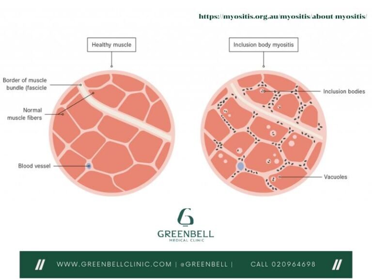 เกี่ยวกับ กรีนเบลล์ สหคลินิก, Greenbell Clinic