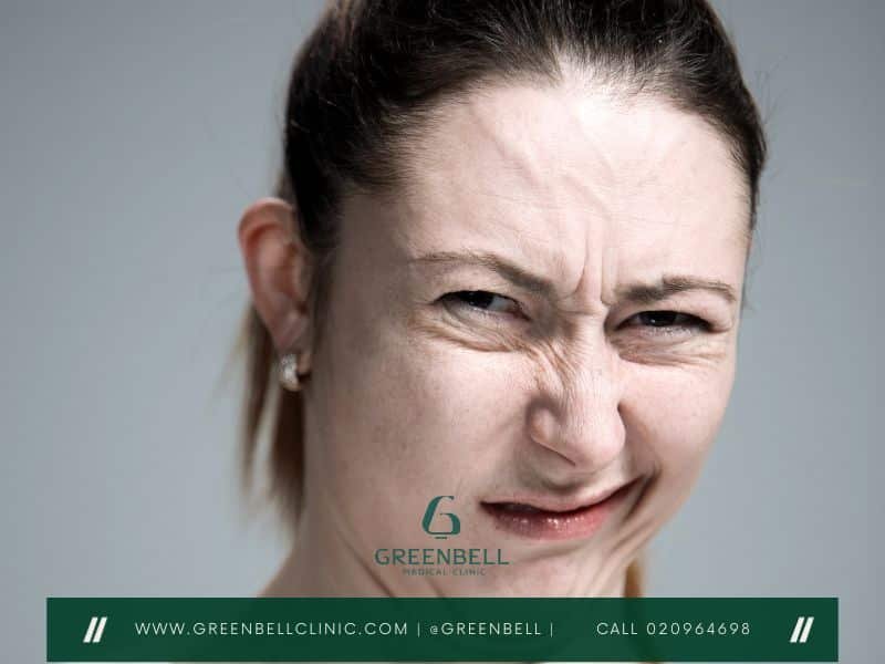 Bell's Palsy,Facial Paralysis, Greenbell Clinic