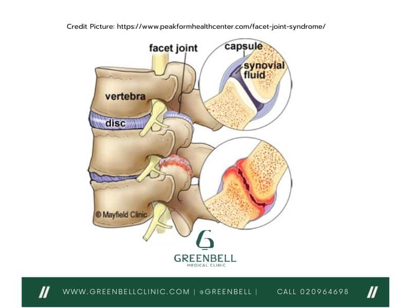 Lumbar Spine, Greenbell Clinic