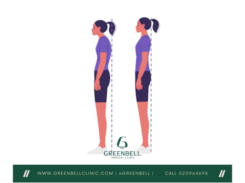 Low crossed Syndrome, Greenbell Clinic