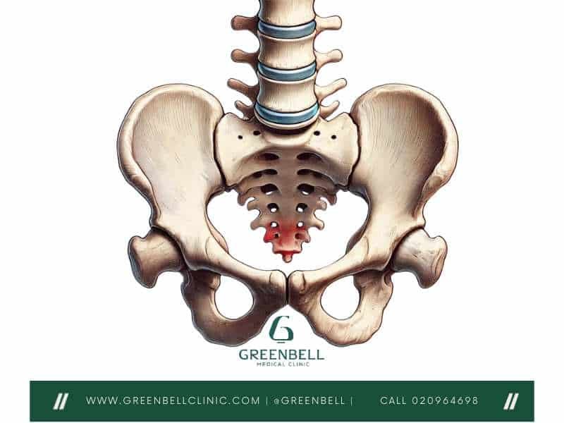 Coccygeal Vertebrae, Greenbell Clinic