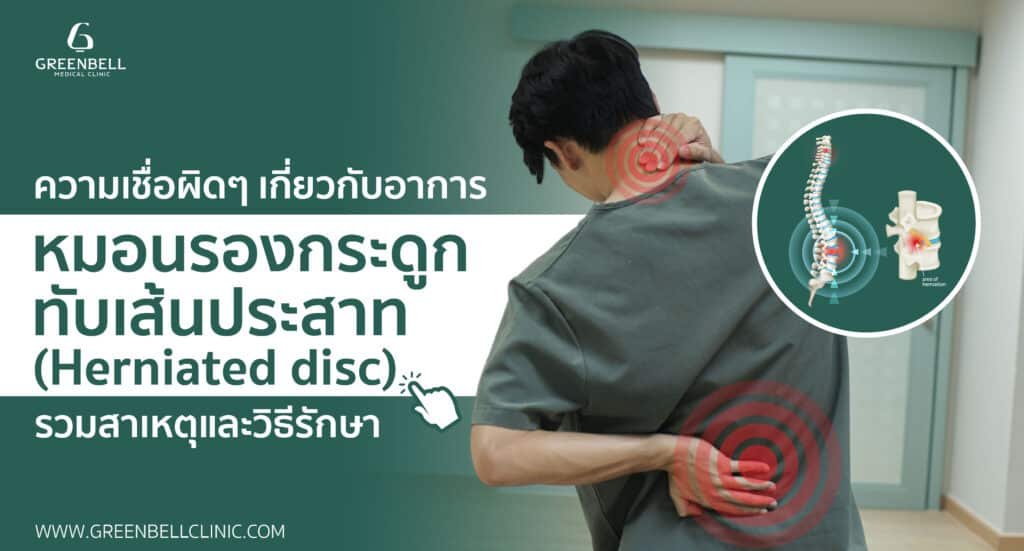ความเชื่อผิดๆ เกี่ยวกับอาการ "หมอนรองกระดูกทับเส้นประสาท"