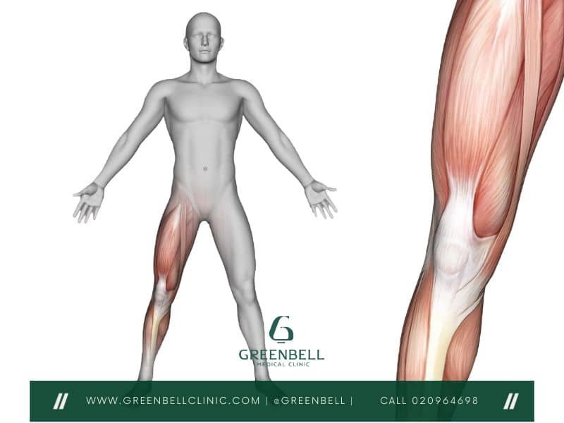 groin strain,groin pain, Greenbell Clinic