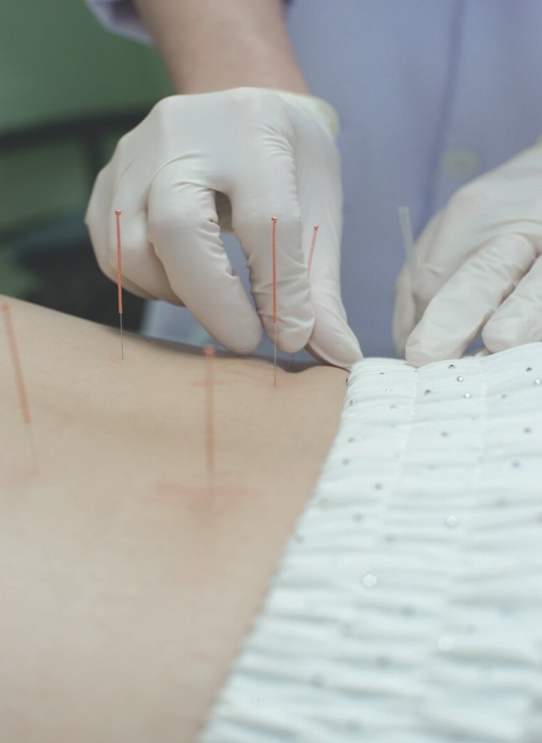 คลินิกกายภาพบำบัด,physiotherapy clinic,คลินิกกายภาพบำบัด ใกล้ฉัน, Greenbell Clinic