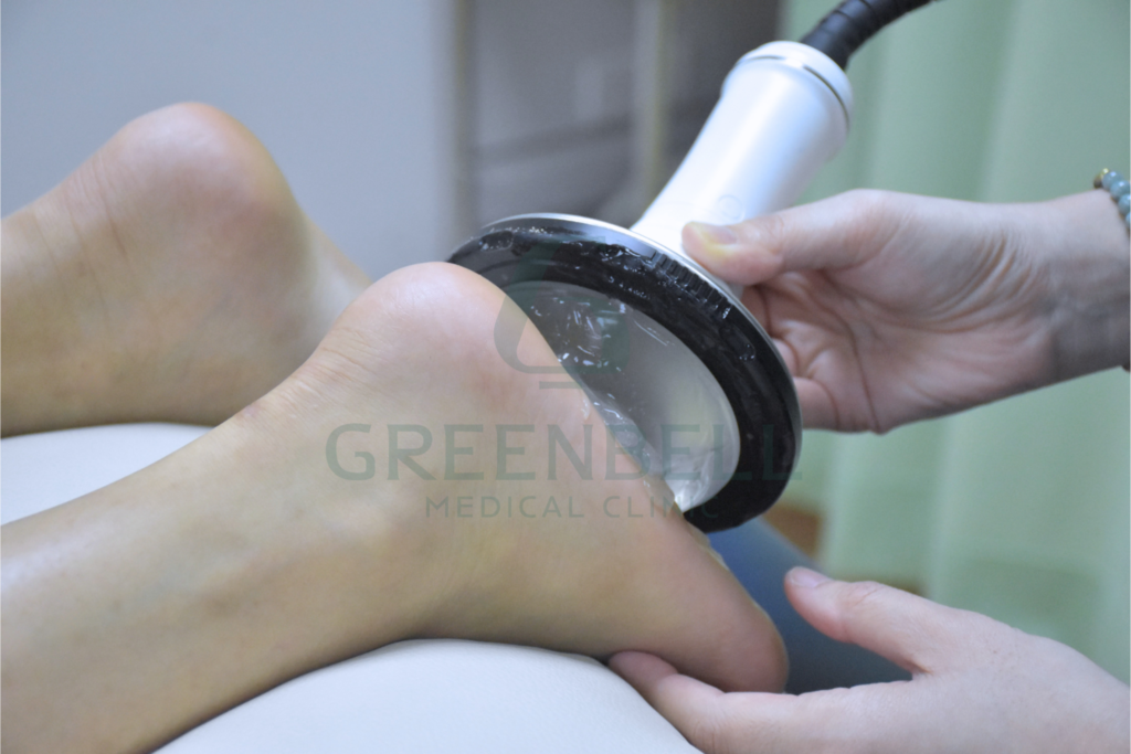 ปวดส้นเท้าตอนเช้า? รู้จักโรครองช้ำ (Plantar Fasciitis) และวิธีรักษาด้วยกายภาพบำบัด โรครองช้ำ โรครองช้ำ, Greenbell Clinic