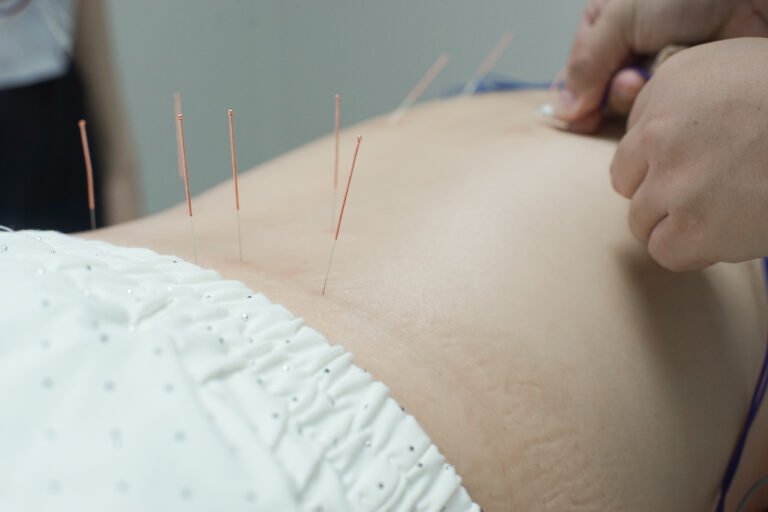 คลินิกกายภาพบำบัด,physiotherapy clinic,คลินิกกายภาพบำบัด ใกล้ฉัน, Greenbell Clinic