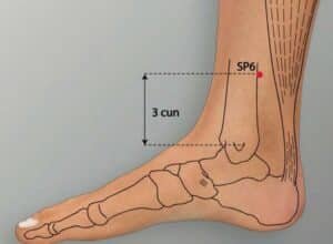 การฝังเข็มรักษาภาวะเสื่อมสมรรถภาพทางเพศ